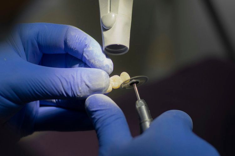 Gloved hands shaping a custom-made dental bridge with a rotary handpiece