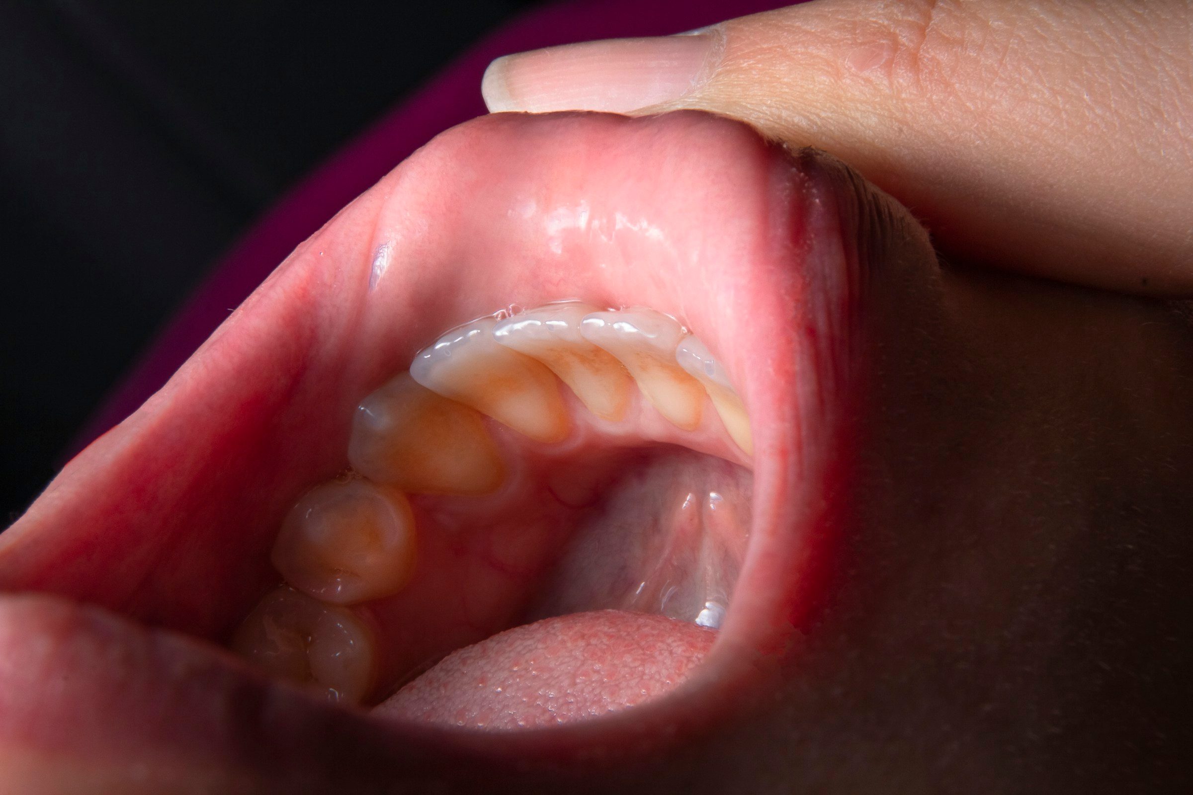 A dentist examining a patient's mouth — at Campos Dental every check-up includes a soft-tissue and oral-cancer screening